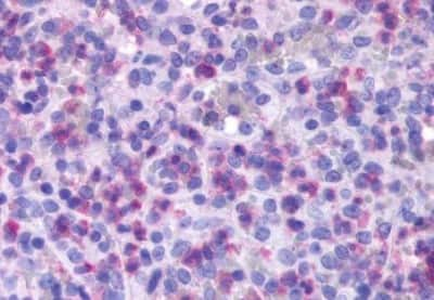 Immunohistochemistry-Paraffin: FPR1 Antibody [NBP3-14321]